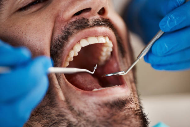 Best TMJ/TMD Treatment  in Covedale, OH